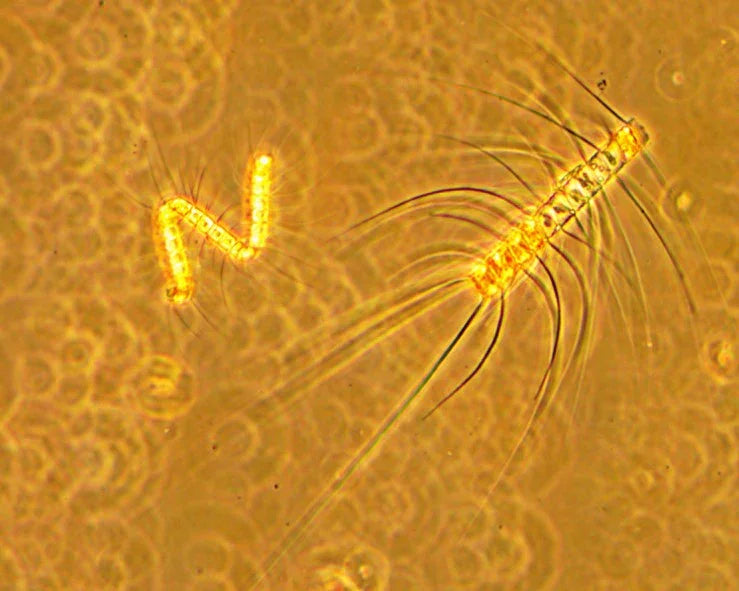 Plancton marin vu au microscope, organisme vivant pour aquarium récifal, fond orange.
